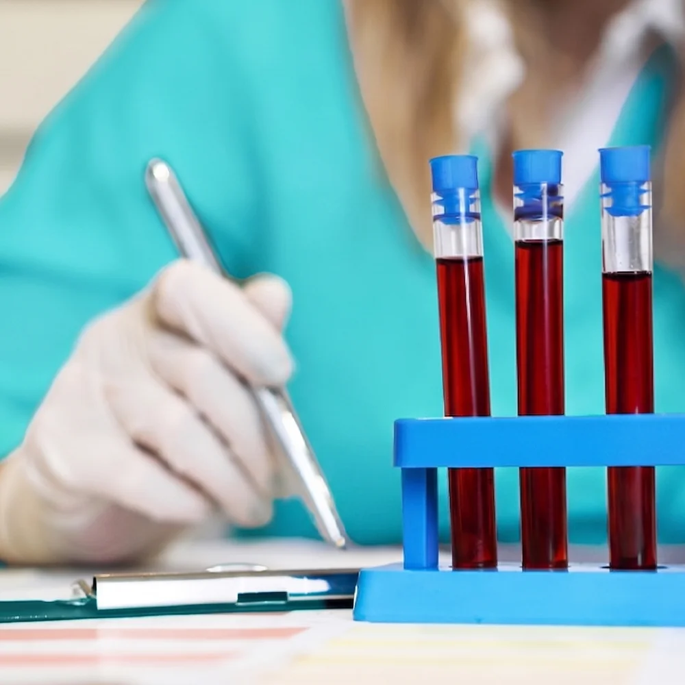 Consultant writing up blood test results