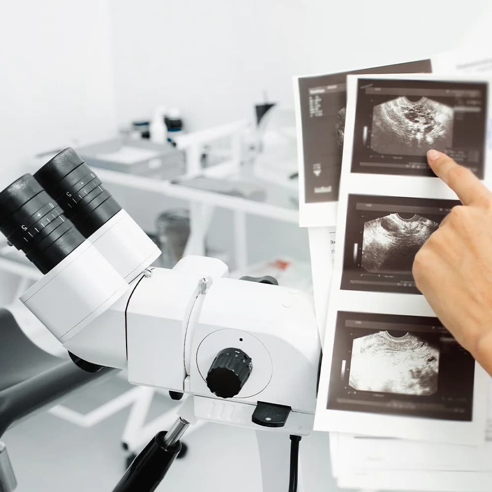 Consultant reviewing colposcopy scan printouts