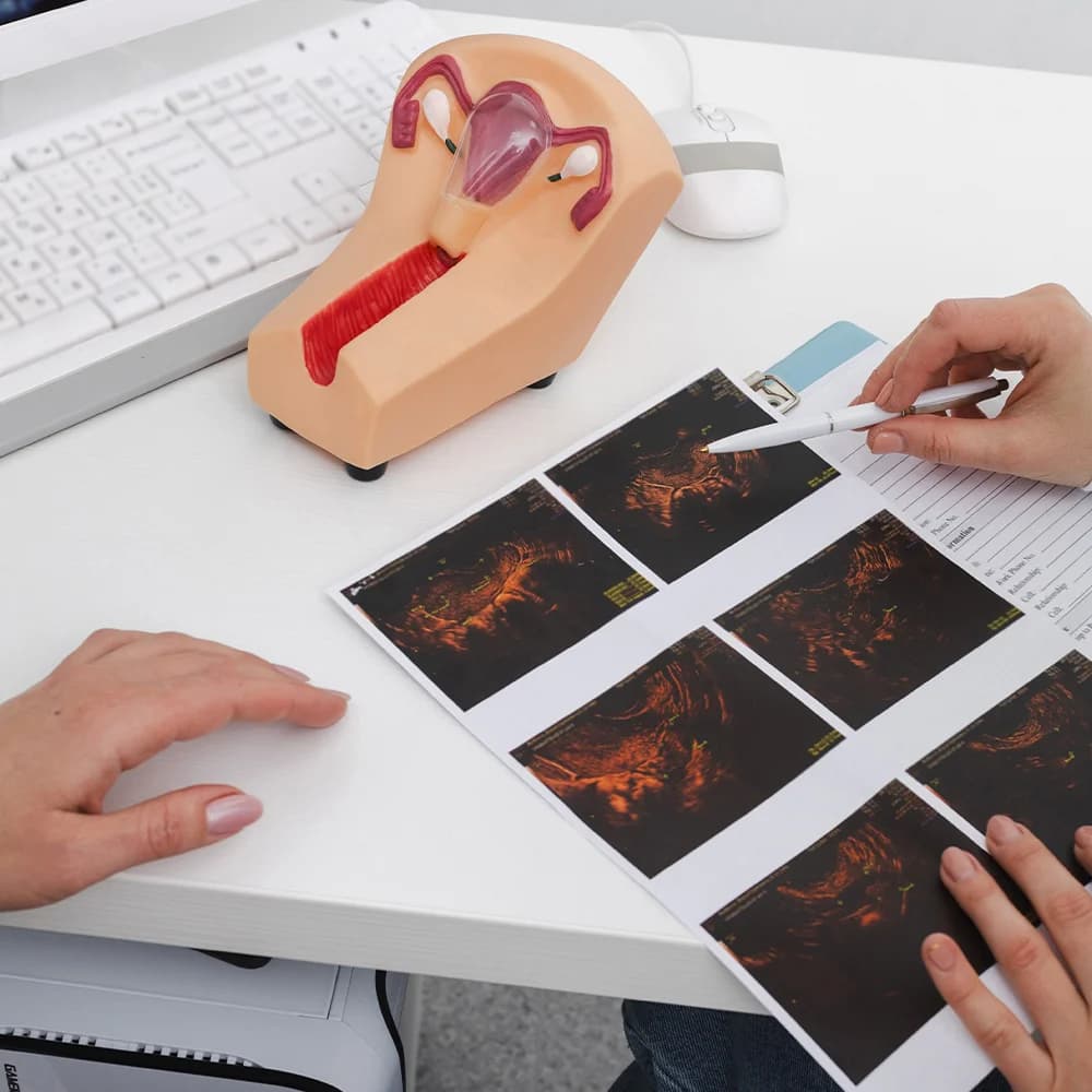 Uterus model and ultrasound scan printouts on a desk